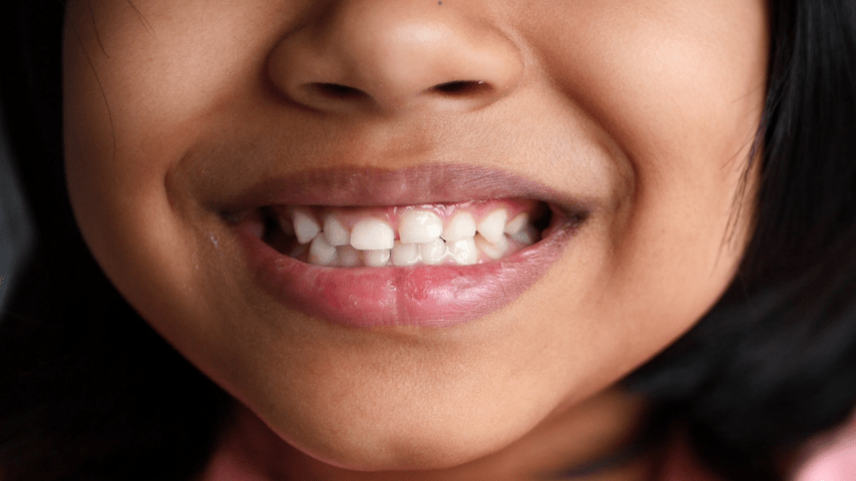 Your child's teeth